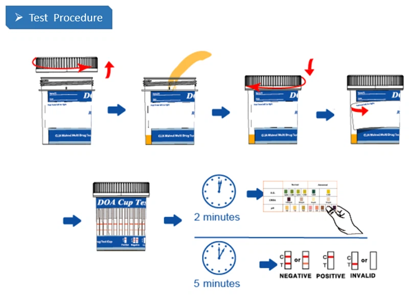 Test procedure Test procedure